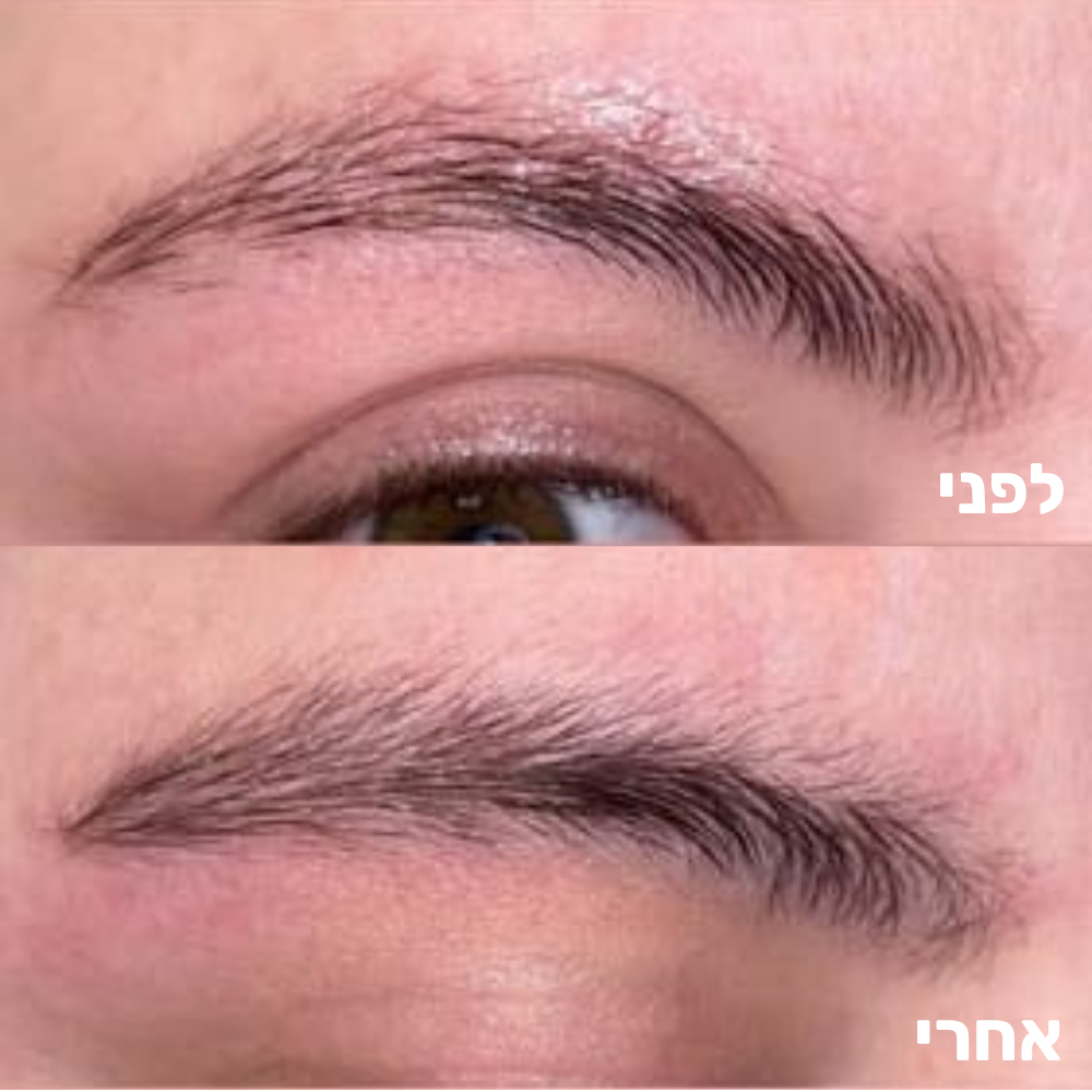 סרום מצמיח גבות