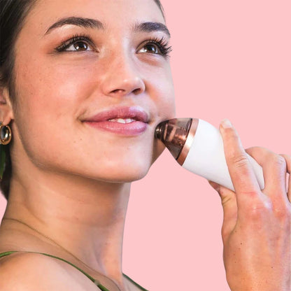 ™SkinFixer | מכשיר להסרת שחורים, ניקוי נקבוביות וחידוש העור