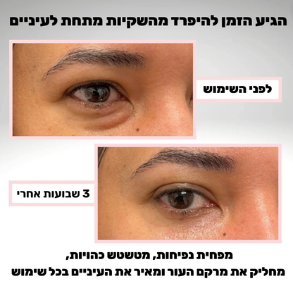 סרום איי גלאו למראה עיניים רענן יותר