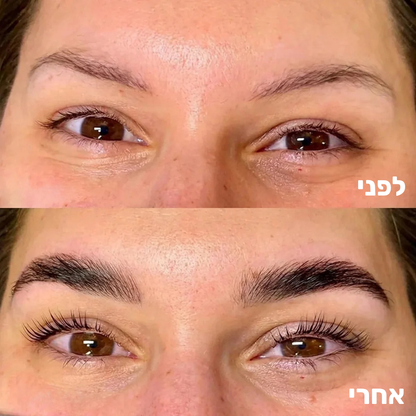 סרום מצמיח גבות