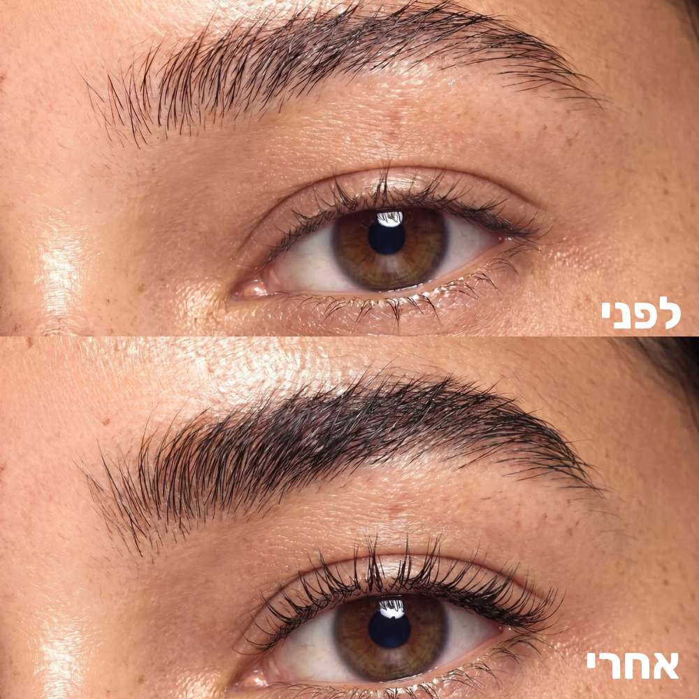 סרום מצמיח גבות