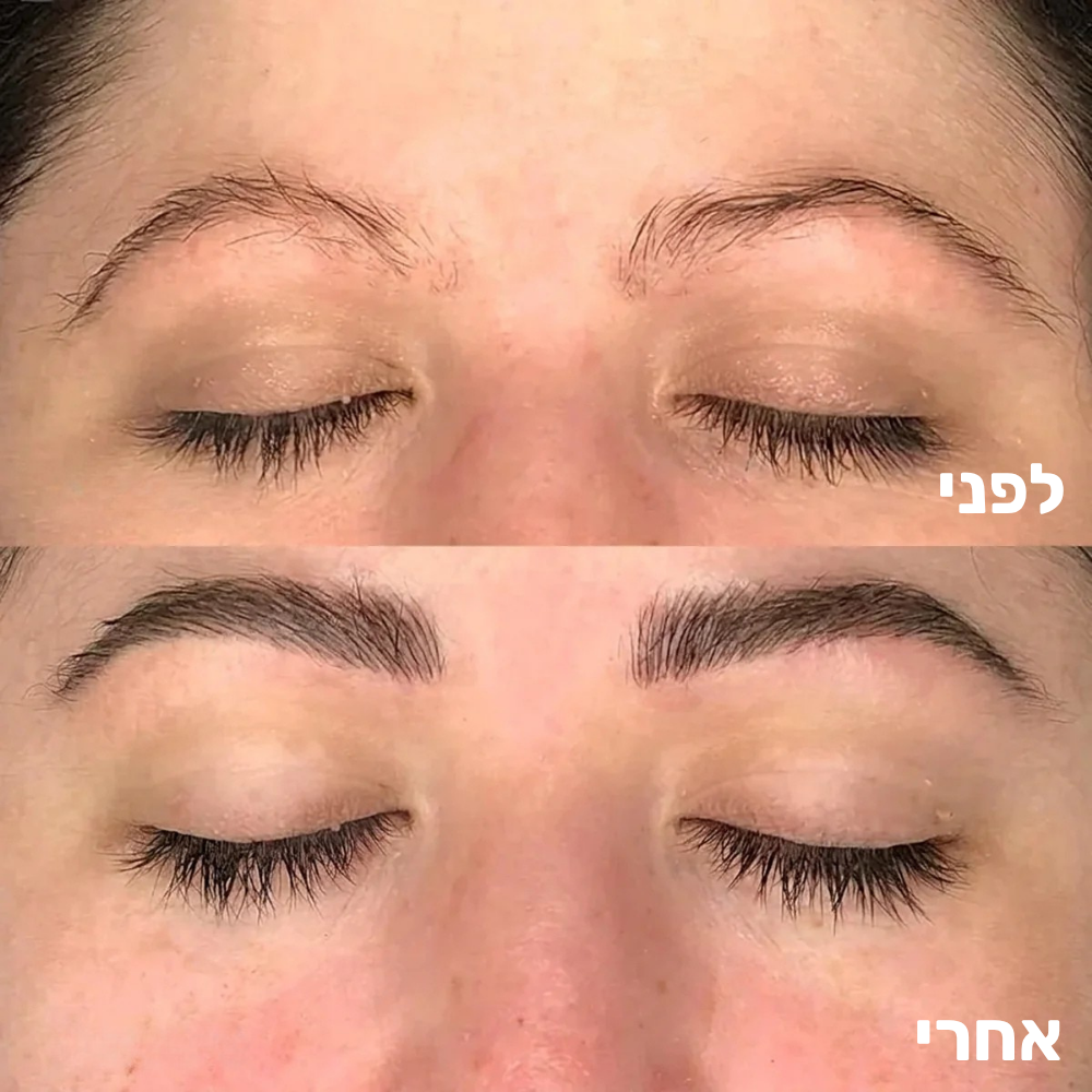 סרום מצמיח גבות