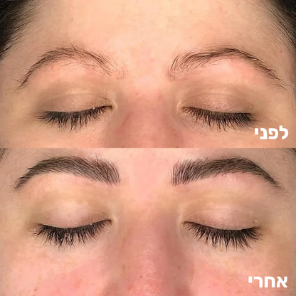 סרום מצמיח גבות
