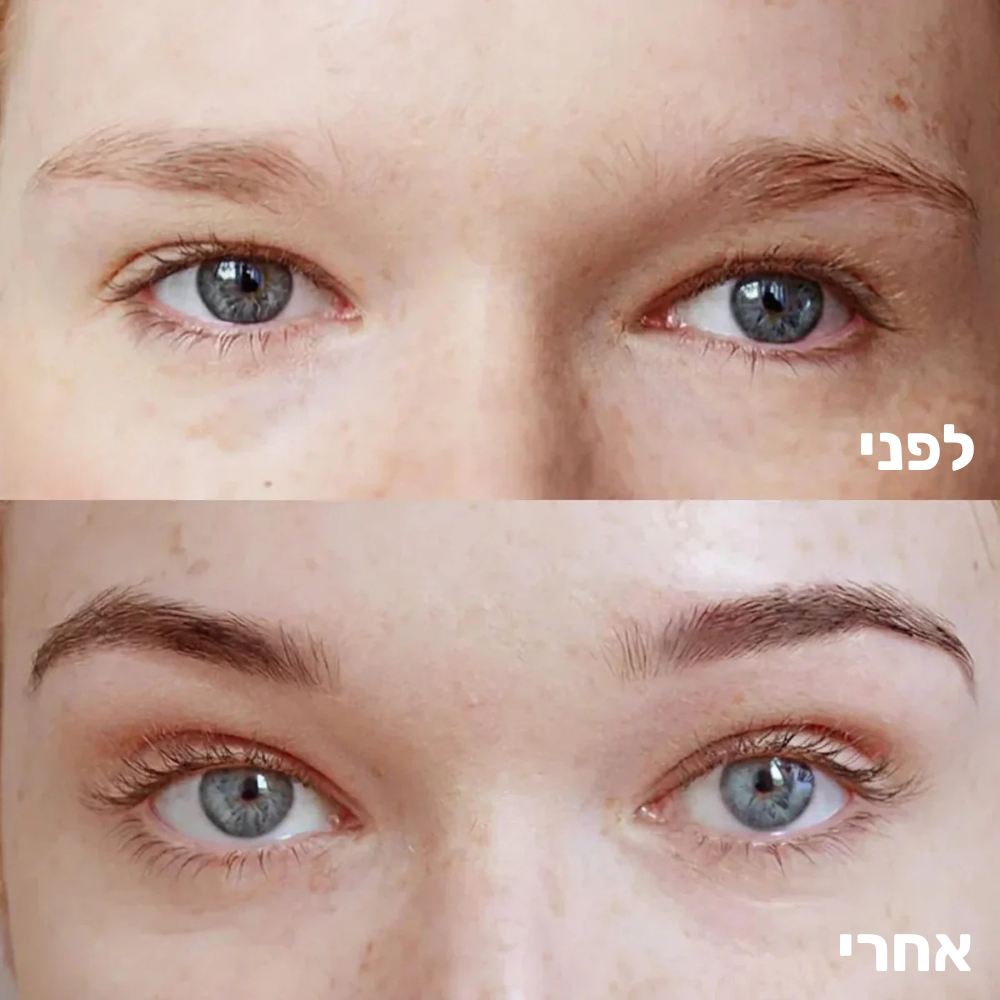 סרום מצמיח גבות