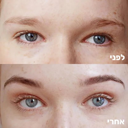 סרום מצמיח גבות