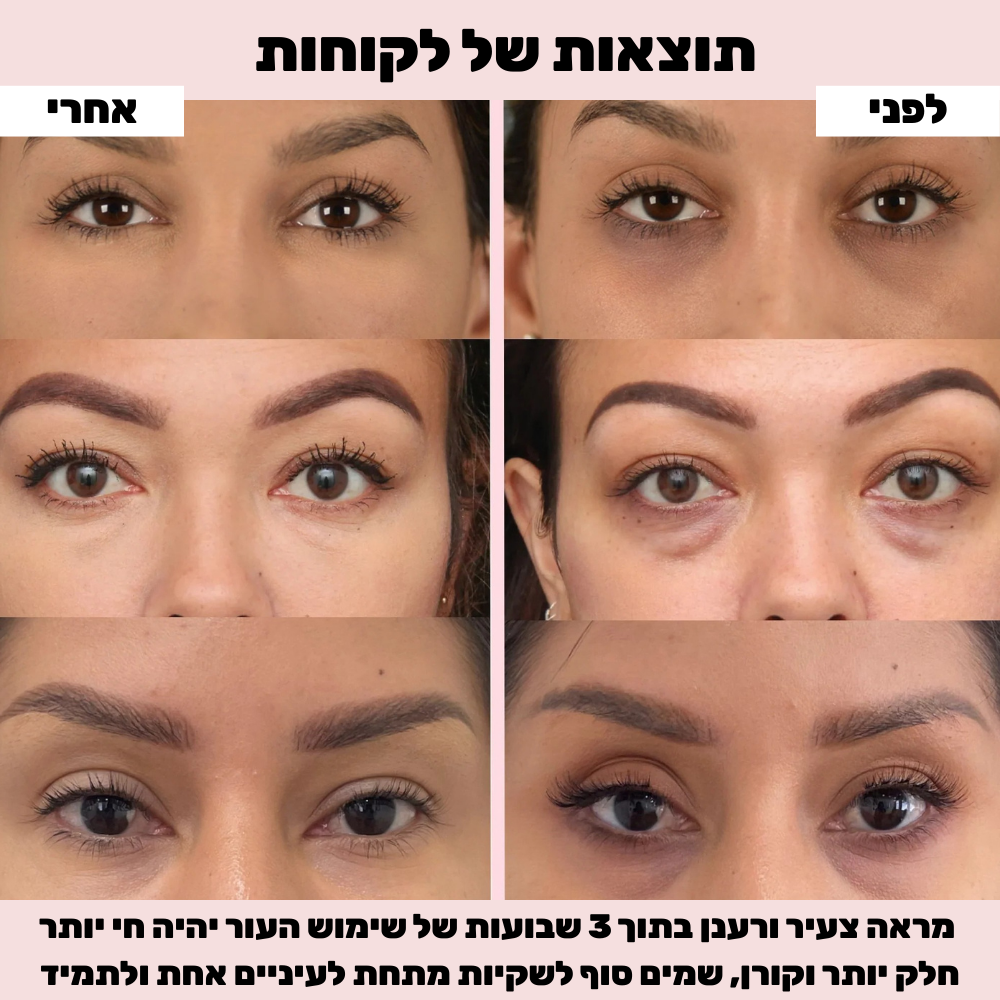 סרום איי גלאו למראה עיניים רענן יותר
