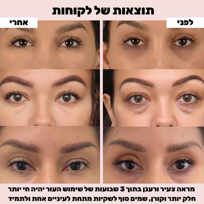 סרום איי גלאו למראה עיניים רענן יותר