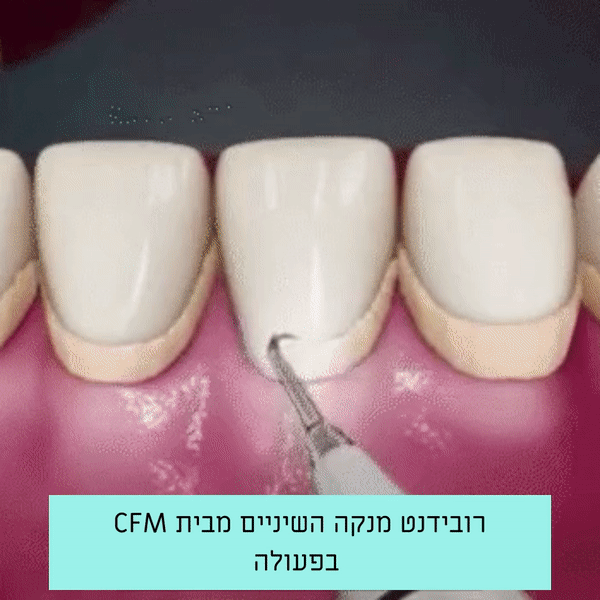 עט הסליל | מסיר שיער מקצועי מהגבות ומהפנים (Copy)