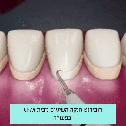 עט הסליל | מסיר שיער מקצועי מהגבות ומהפנים (Copy)