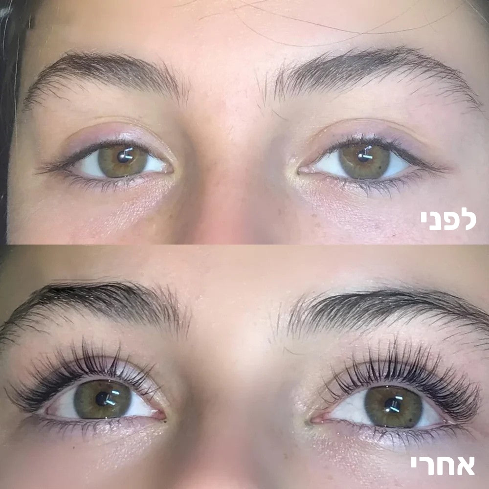 before after של סרום הריסים MY TIME לריסים ארוכים ומלאים יותר 'imagebadge'