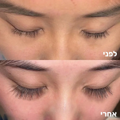 לפני ואחרי סרום ריסים MY TIME לשיפור צפיפות ועובי הריסים 'imagebadge'
