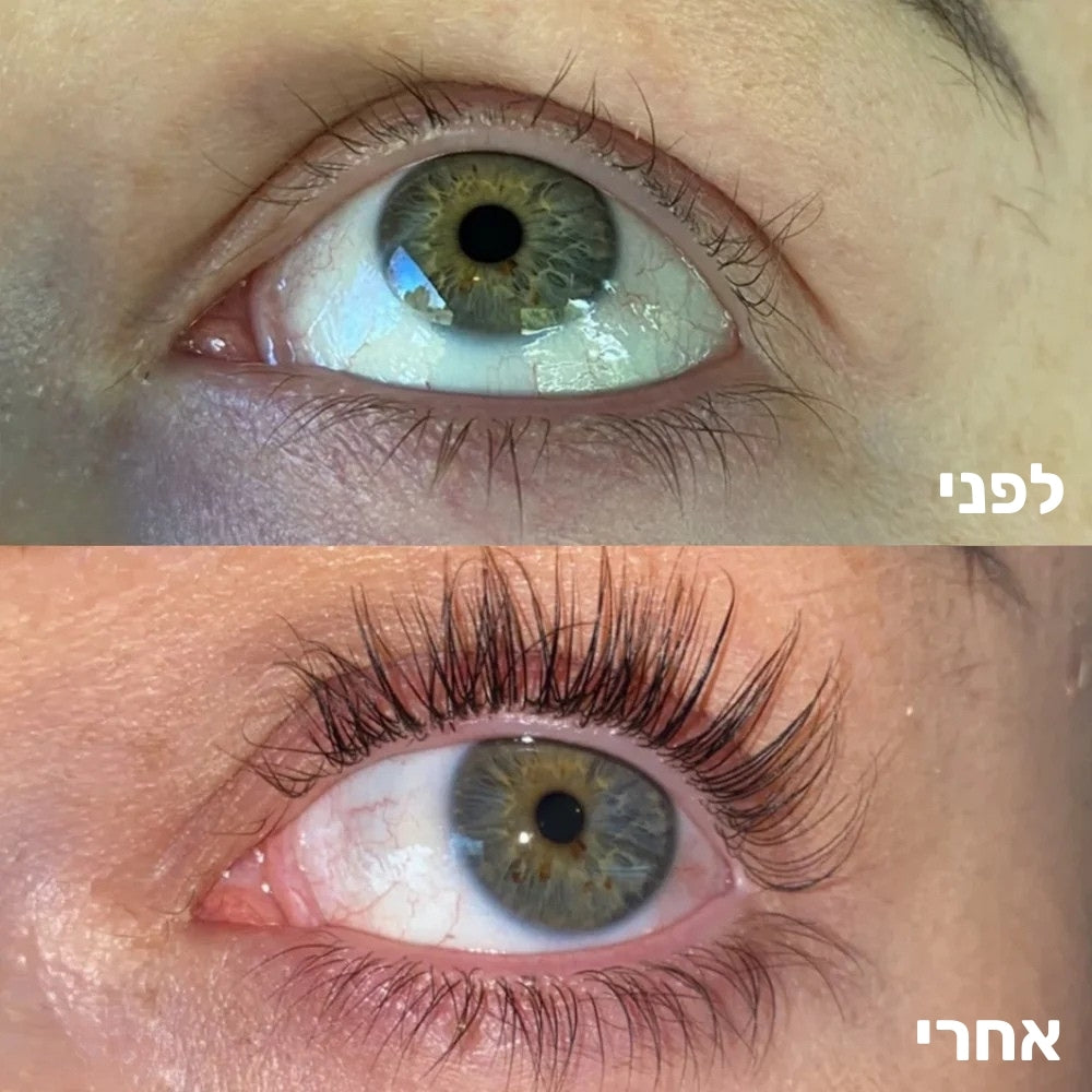 לפני ואחרי שימוש בסרום ריסים MY TIME תוצאה בריסים בהירים 'imagebadge'