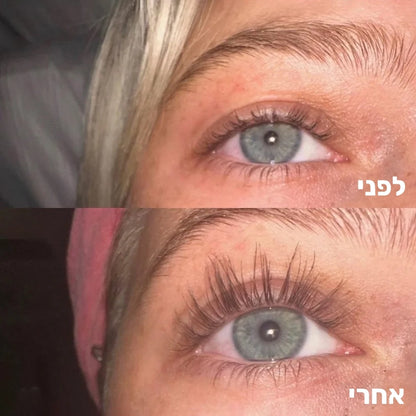 תוצאות צמיחת ריסים על ריסים בהירים לאחר שימוש יומי בסרום MY TIME 'imagebadge'